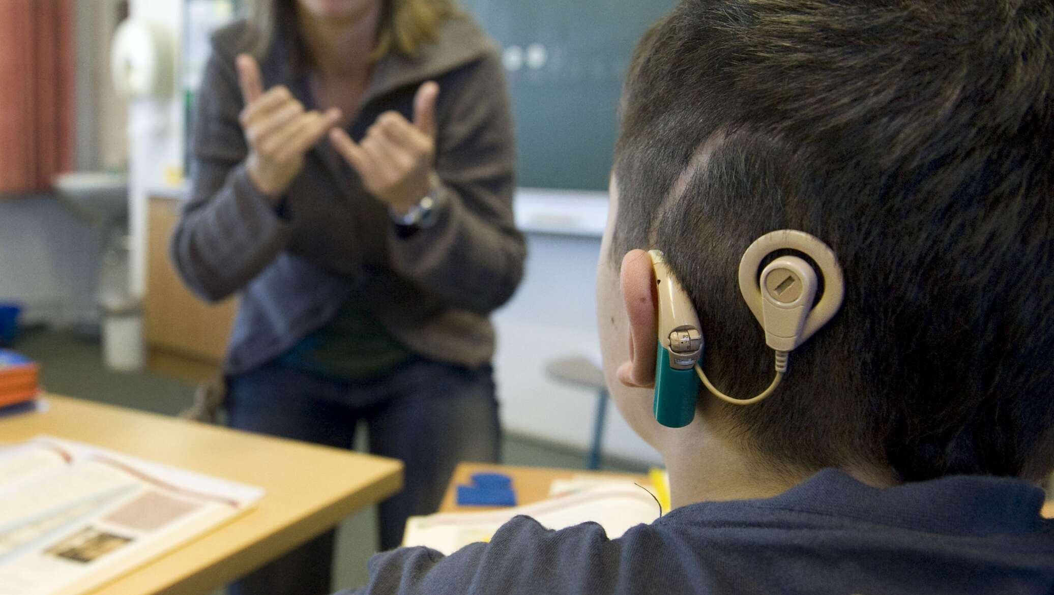 Слабослышащие учащиеся. Аппарат для глухих кохлеарная имплантация. Кохлеарная имплантация Cochlear. Кохлеарный имплант Кохлер. Слуховой аппарат для глухих.