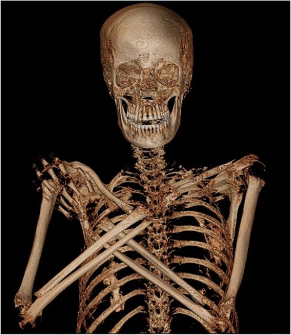 Радиологическая экспертиза древней мумии, которая была обнаружена в королевских гробницах в Верхнем Египте, доказала, что это тело беременной женщины  - Sputnik Азербайджан