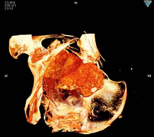 Радиологическая экспертиза древней мумии, которая была обнаружена в королевских гробницах в Верхнем Египте, доказала, что это тело беременной женщины  - Sputnik Азербайджан