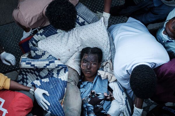 Раненая жительница деревни Тогоги в Эфиопии, пострадавшая от авиаудара - Sputnik Azərbaycan