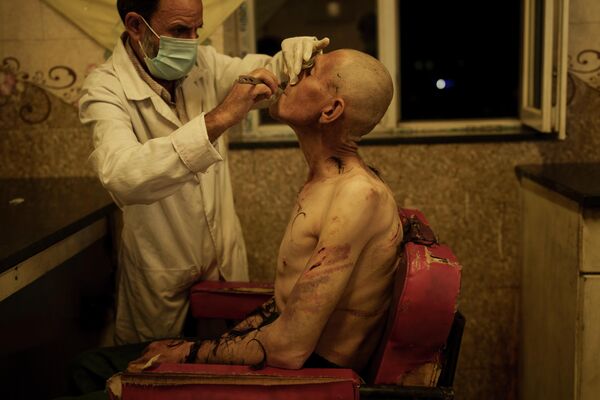 Наркоман, которому бреют голову в отделении детоксикации в больнице Кабула, Афганистан. - Sputnik Азербайджан