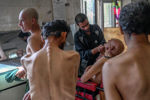 Наркоман, которому бреют голову в отделении детоксикации в больнице Кабула, Афганистан. - Sputnik Азербайджан