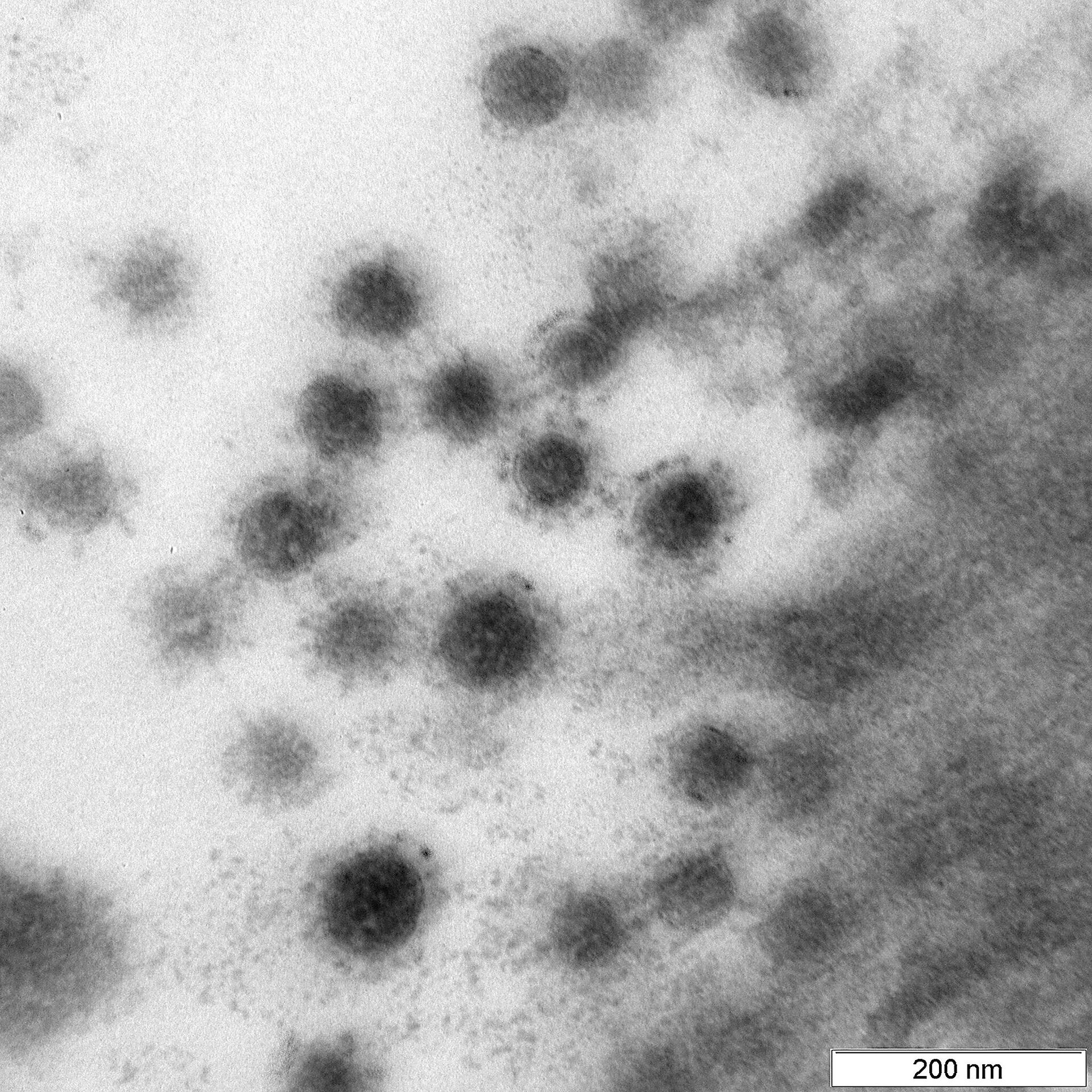Центр Вектор опубликовал фото дельта-штамма коронавируса - Sputnik Azərbaycan, 1920, 25.10.2021