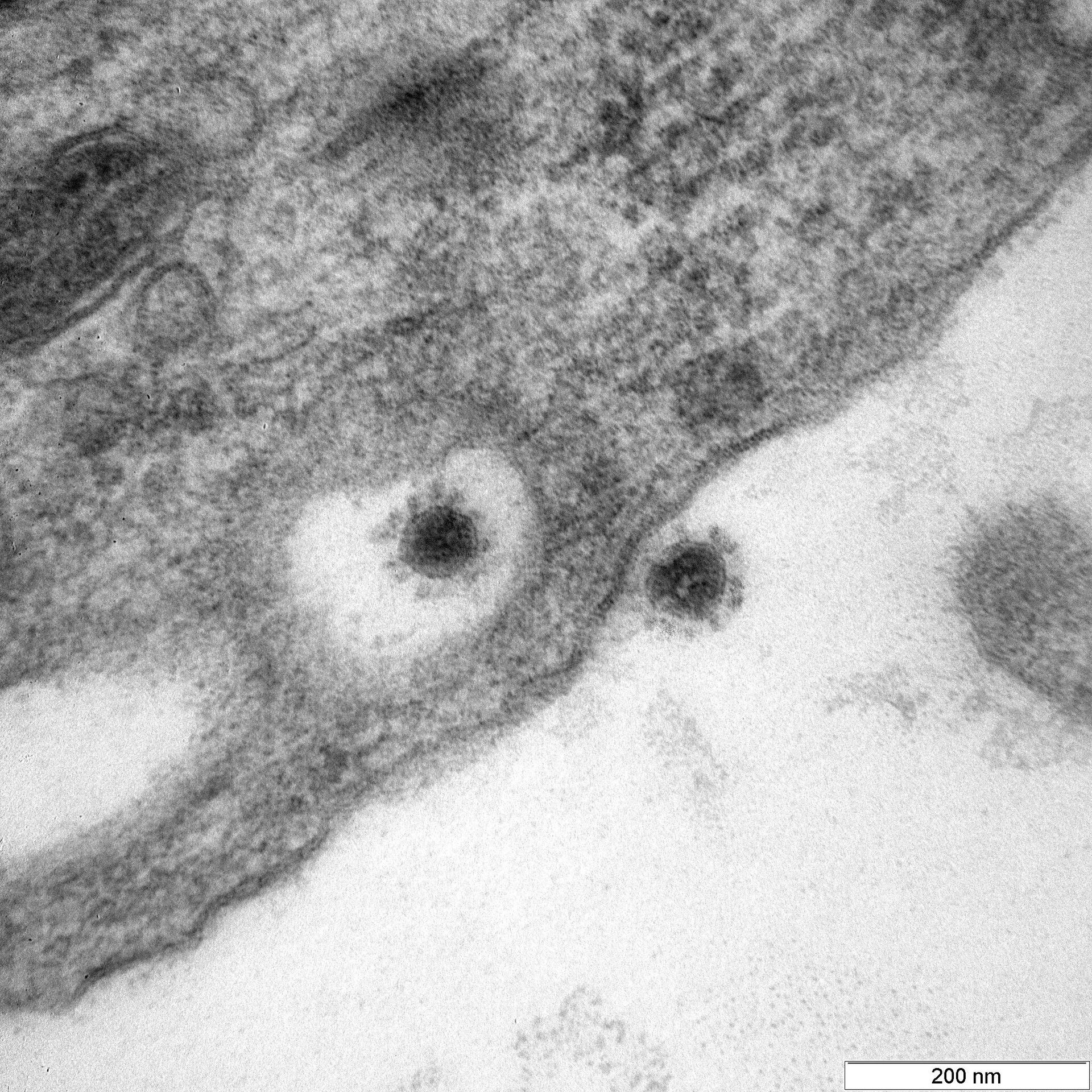 Центр Вектор опубликовал фото дельта-штамма коронавируса - Sputnik Azərbaycan, 1920, 06.01.2023