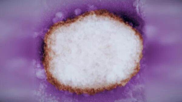 Вирус оспы обезьян под электронным микроскопом. Архивное фото - Sputnik Азербайджан