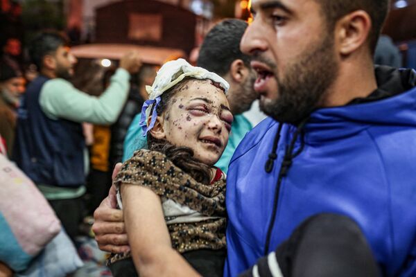 Раненые палестинцы, эвакуированные из индонезийской больницы на севере сектора Газа. - Sputnik Азербайджан