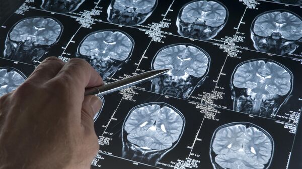МРТ-сканирование головного мозга головы  - Sputnik Азербайджан