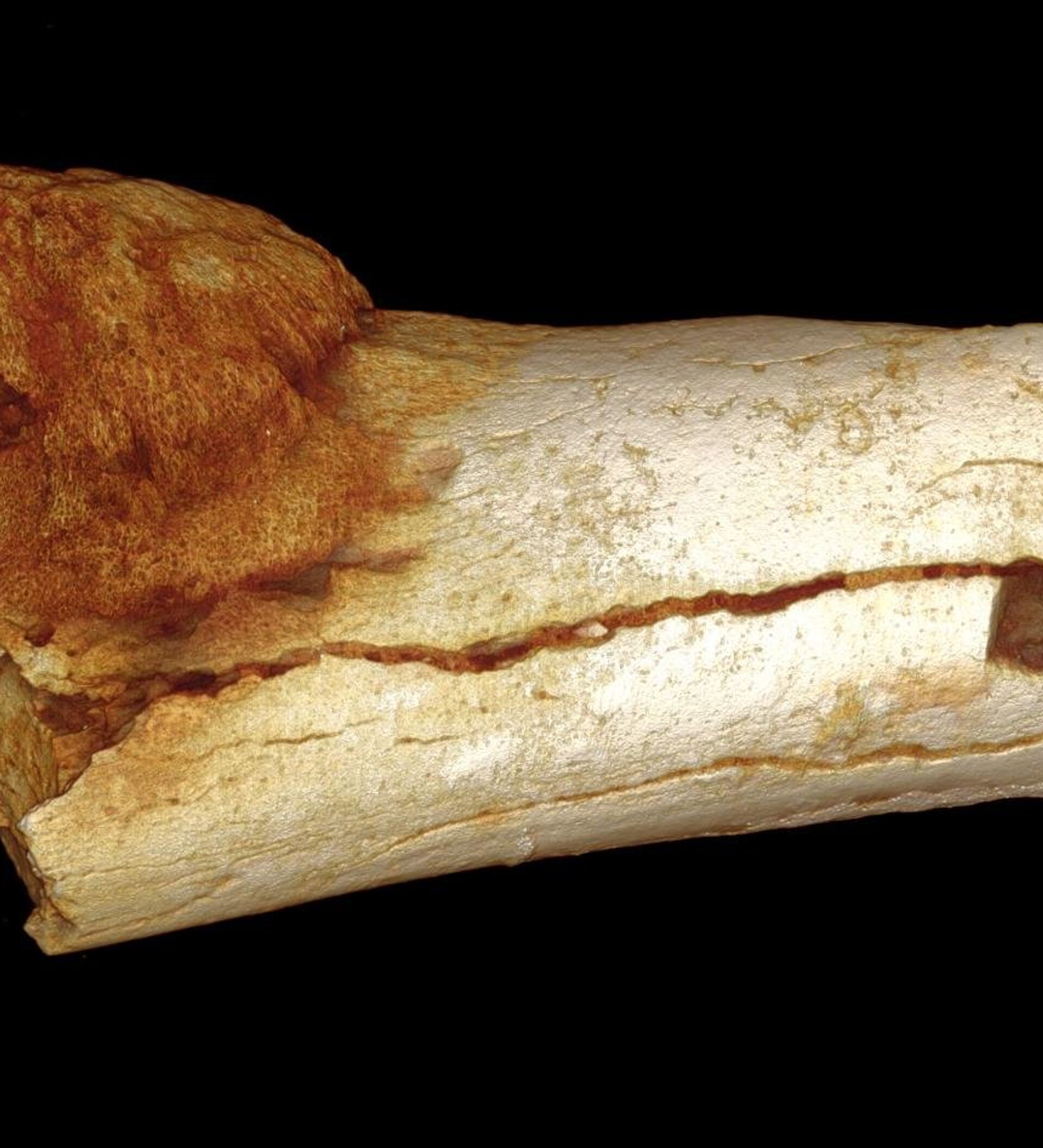 Old bone. Злокачественная опухоль кости. Онкология в древние времена. Самые древние сайты.
