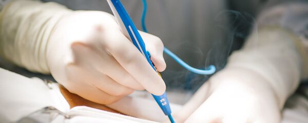 Операция по удалению злокачественной опухоли, фото из архива Операция по удалению злокачественной опухоли, фото из архива - Sputnik Азербайджан