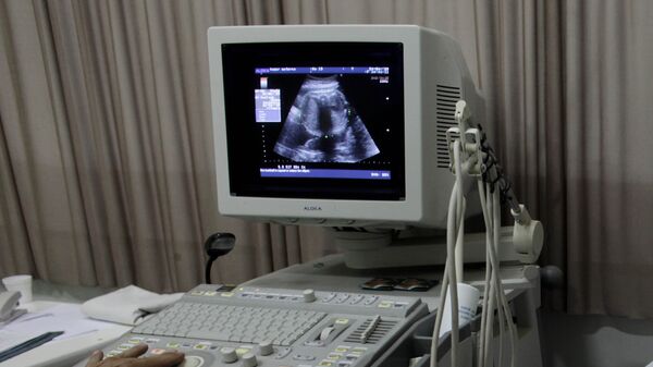 Изображение на экране монитора аппарата УЗИ во время обследования беременной женщины, фото из архива - Sputnik Azərbaycan