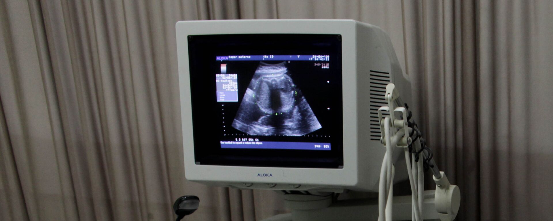 Изображение на экране монитора аппарата УЗИ во время обследования беременной женщины, фото из архива - Sputnik Азербайджан, 1920, 05.09.2021