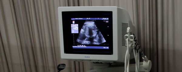 Изображение на экране монитора аппарата УЗИ во время обследования беременной женщины, фото из архива - Sputnik Азербайджан