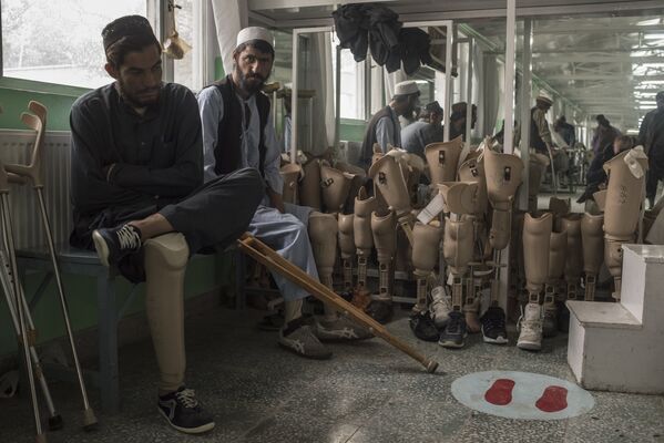 Ортопедическая клиника в Кабуле - Sputnik Азербайджан