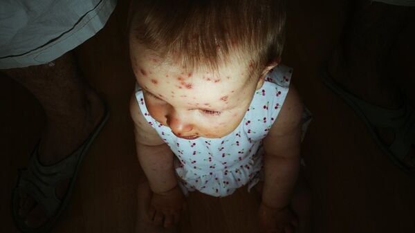 Больной ребенок, фото из архива - Sputnik Азербайджан
