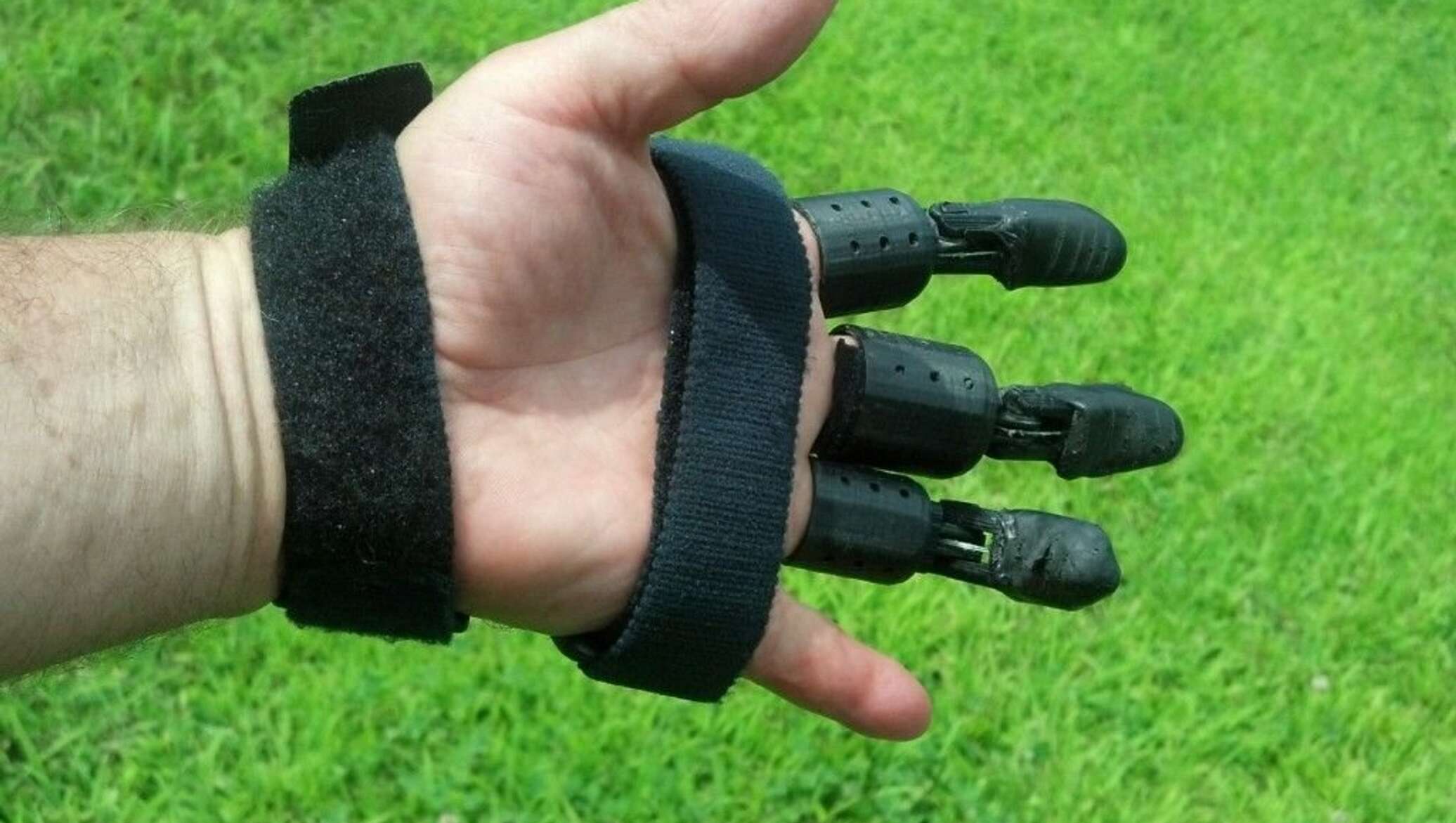 Бионические протезы пальцев