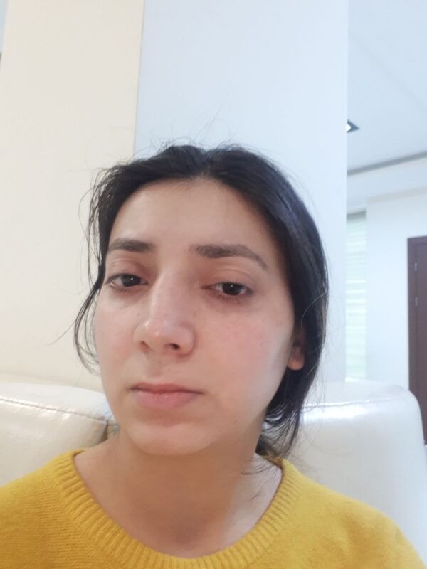 Arzu Hümbətova estetik əməliyyatdan sonra Arzu Hümbətova estetik əməliyyatdan sonra - Sputnik Azərbaycan
