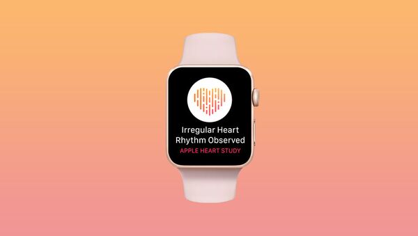 Часы Apple Watch с программой Heart Study - Sputnik Азербайджан