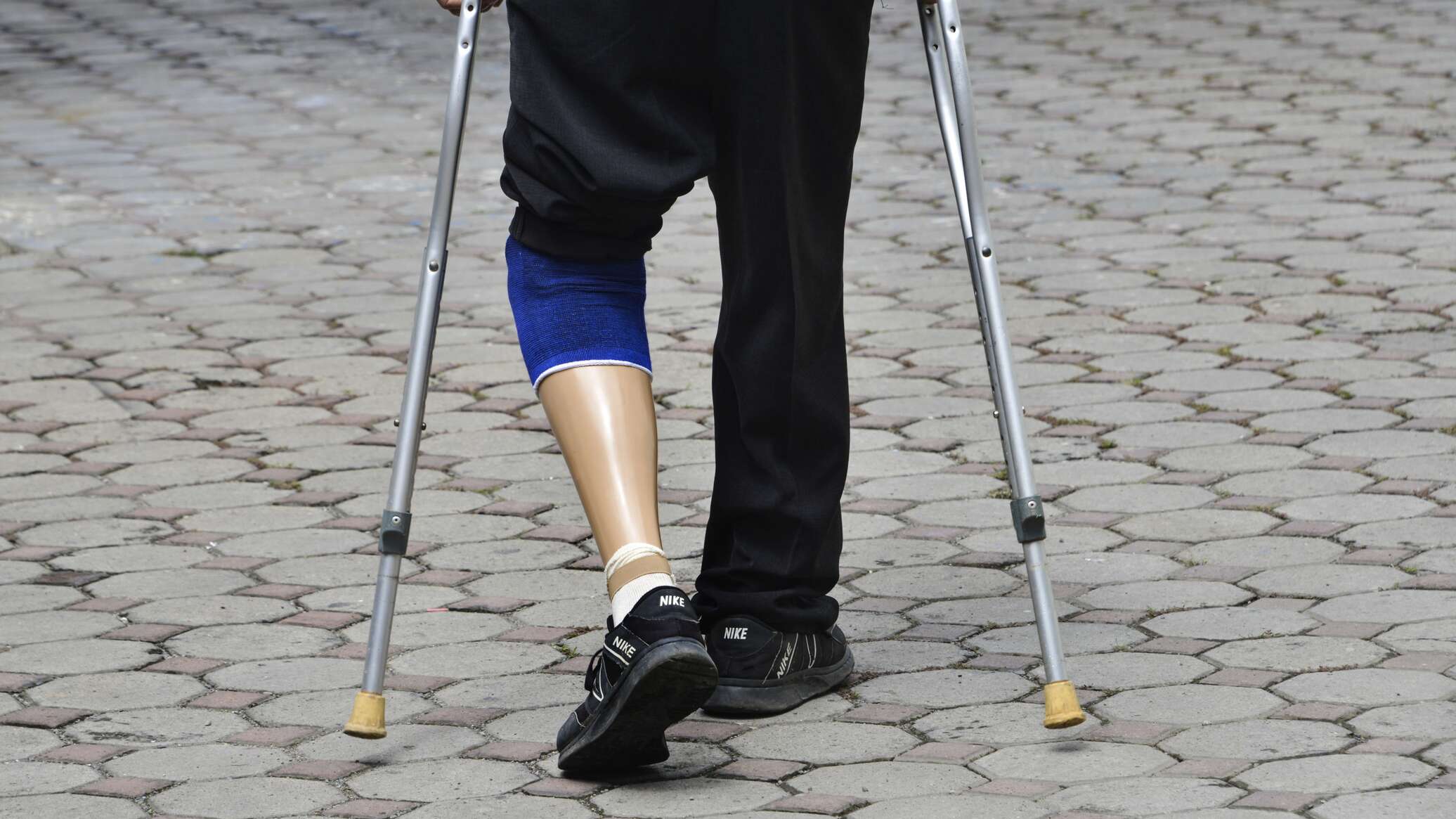 Военные инвалиды по заболеванию. Реабилитация военнослужащий инвалид. Инвалидность в Азербайджане. Инвалид войны автомобиль.