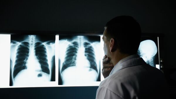 Врач осматривает рентгеновские снимки грудной клетки - Sputnik Azərbaycan
