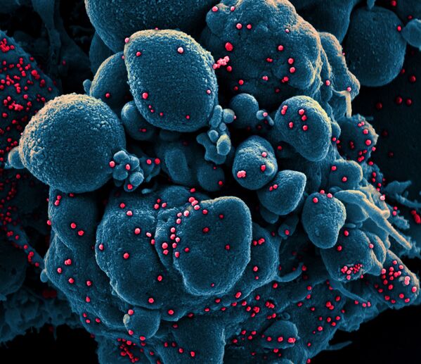 Colorized scanning electron micrograph of an apoptotic cell (blue) infected with SARS-COV-2 virus particles (red), also known as novel coronavirus, isolated from a patient sample. Image captured at the NIAID Integrated Research Facility (IRF) in Fort Detrick, Maryland.  - Sputnik Азербайджан