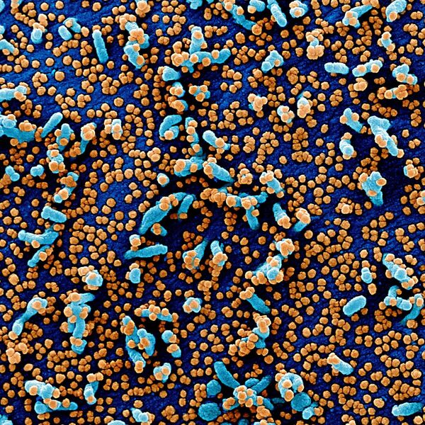 Colorized scanning electron micrograph of a VERO E6 cell (blue) heavily infected with SARS-COV-2 virus particles (orange), also known as novel coronavirus, isolated from a patient sample. Image captured and color-enhanced at the NIAID Integrated Research Facility (IRF) in Fort Detrick, Maryland - Sputnik Азербайджан
