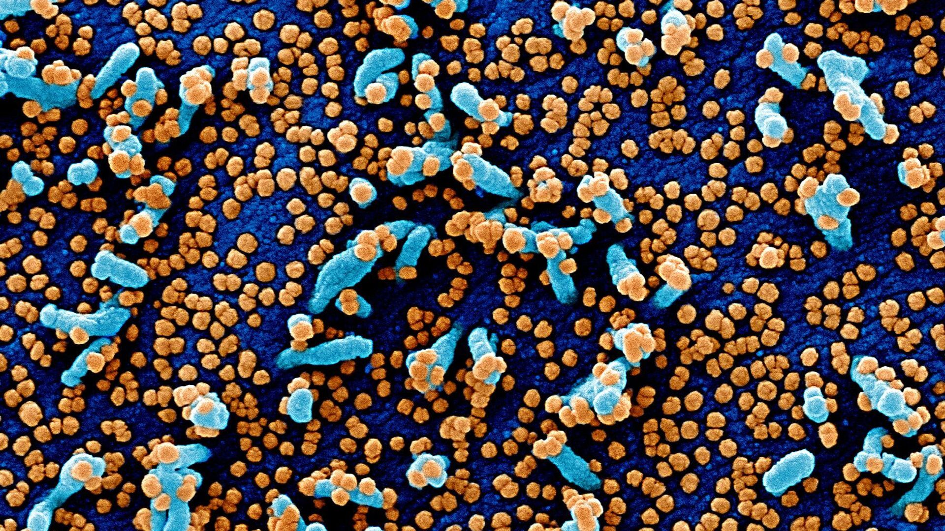 Colorized scanning electron micrograph of a VERO E6 cell (blue) heavily infected with SARS-COV-2 virus particles (orange), also known as novel coronavirus, isolated from a patient sample. Image captured and color-enhanced at the NIAID Integrated Research Facility (IRF) in Fort Detrick, Maryland - Sputnik Azərbaycan, 1920, 26.12.2021