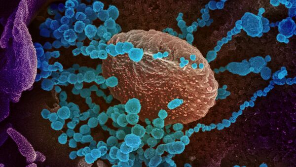 Вид на зараженную коронавирусом  клетку под микроскопом  - Sputnik Азербайджан