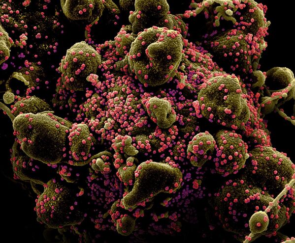 Вид на зараженную коронавирусом клетку под микроскопом - Sputnik Азербайджан