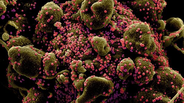 Вид на зараженную коронавирусом клетку под микроскопом - Sputnik Azərbaycan