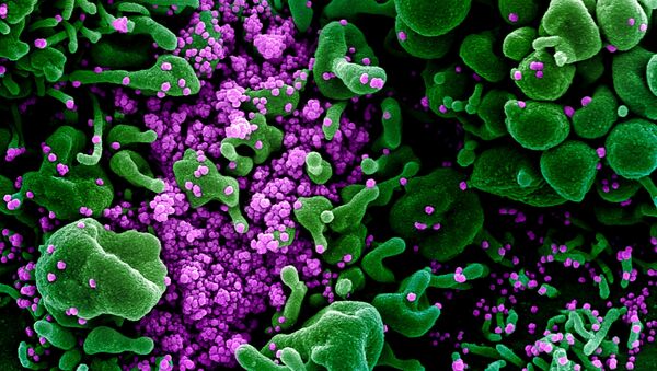 An undated colorized scanning electron micrograph of an apoptotic cell (green) heavily infected with SARS-COV-2 virus particles (purple), also known as novel coronavirus, the virus which causes COVID-19, isolated from a patient sample - Sputnik Azərbaycan