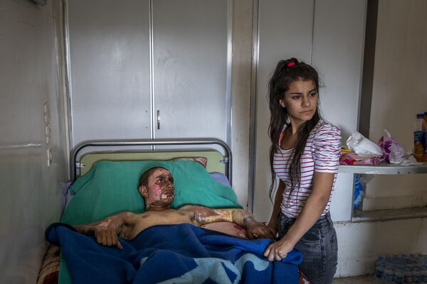 Снимок Injured Kurdish Fighter Receives Hospital Visit фотографа Ivor Prickett, номинант конкурса World Press Photo 2020 - Sputnik Azərbaycan