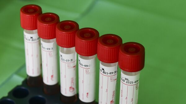 Пробирки с образцами, собранными во время тестов на коронавирус, фото из архива - Sputnik Азербайджан